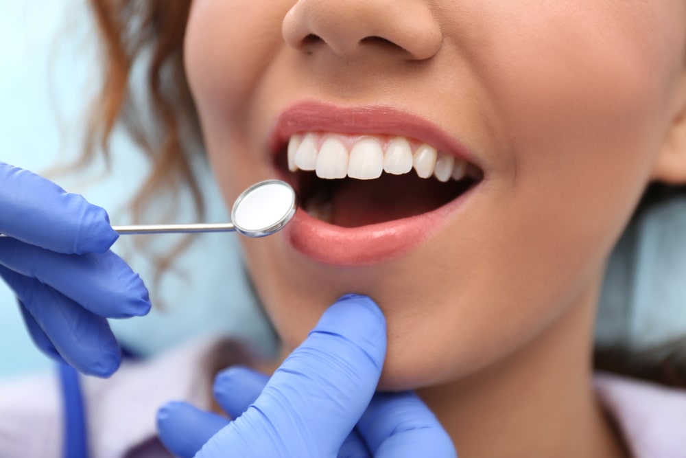 sorriso di donn dopo trattamento di estetica dentale